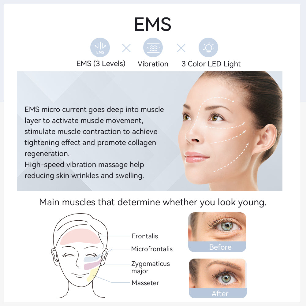 TheraBeam Face Lifting EMS